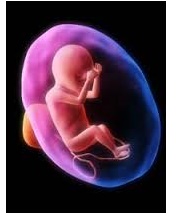 aborto